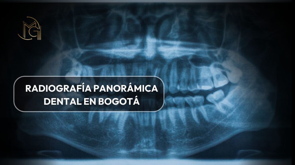 Radiografia panoramica dental en bogota