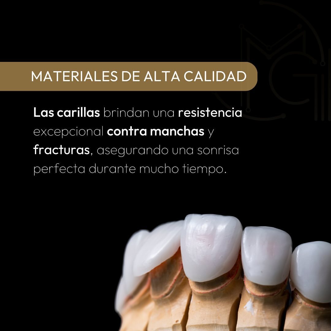 Carillas Dentales en Bogotá - Dr. Carolina Gil - Cirujana Maxilofacial en Bogotá