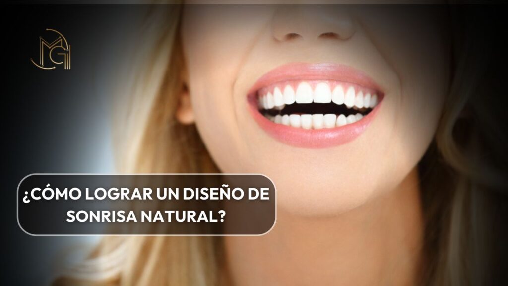 Cómo lograr un diseño de sonrisa natural