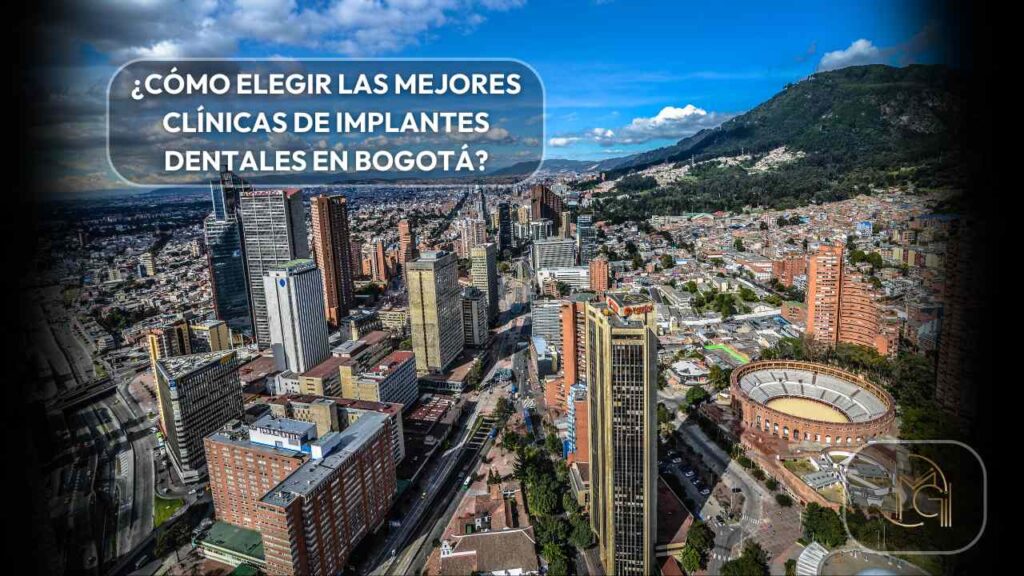 Mejores clínicas de implantes dentales en Bogotá