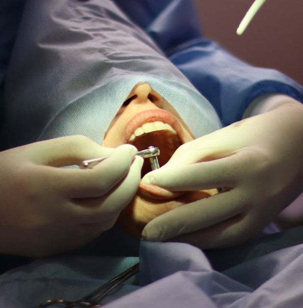 Mejores implantes dentales en Bogotá - Dra. Carolina Gil