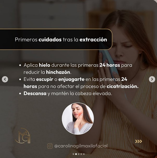 Extracción muelas del juicio