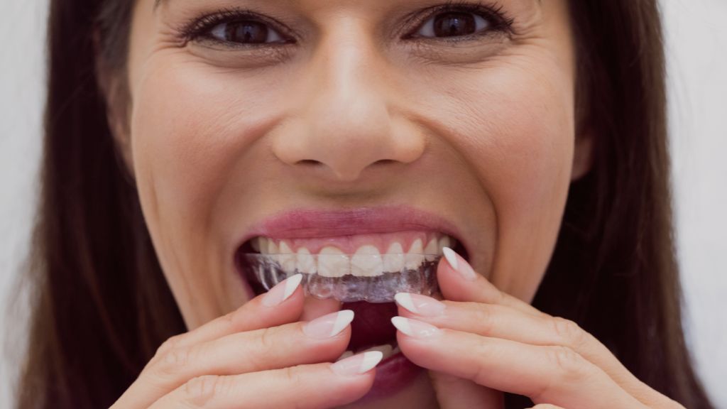 Evidencia científica que respalda el uso de placas miorrelajantes - Dra. Carolina Gil Cirujana Maxilofacial y Oral