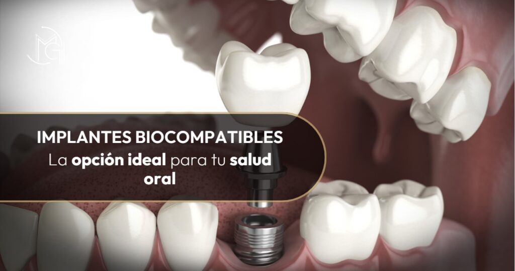 Implantes biocompatibles-Dra. Carolina Gil