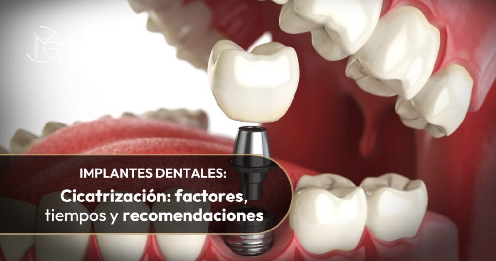 Cicatrización de implantes dentales-Dra. Carolina Gil