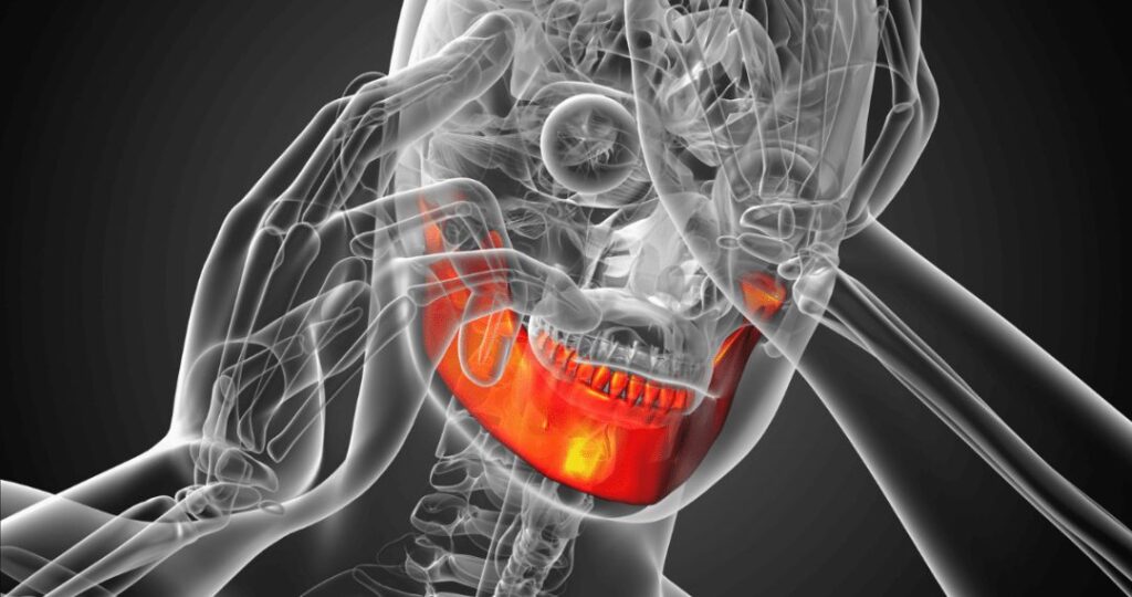 ¿Qué es la tensión muscular por estrés y cómo afecta al cuerpo