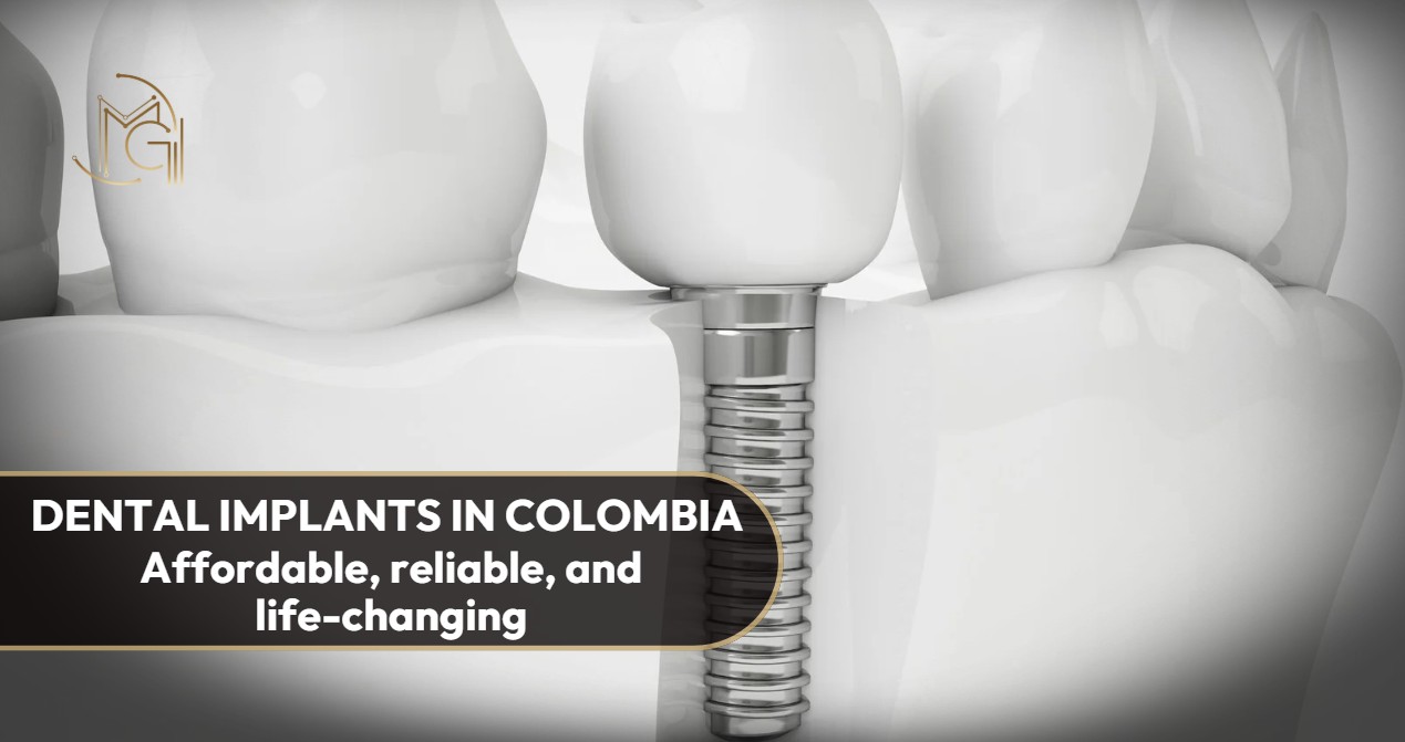 Dental implants in Colombia- Dra. Carolina Gil