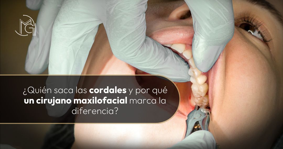 Quién saca las cordales, explicado por la odontóloga y cirujana oral y maxilofacial de Bogotá Carolina Gil