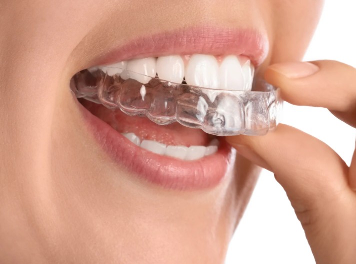 Tratamiento para el bruxismo en la Clínica odontológica en Bogotá de la Dra. Carolina Gil