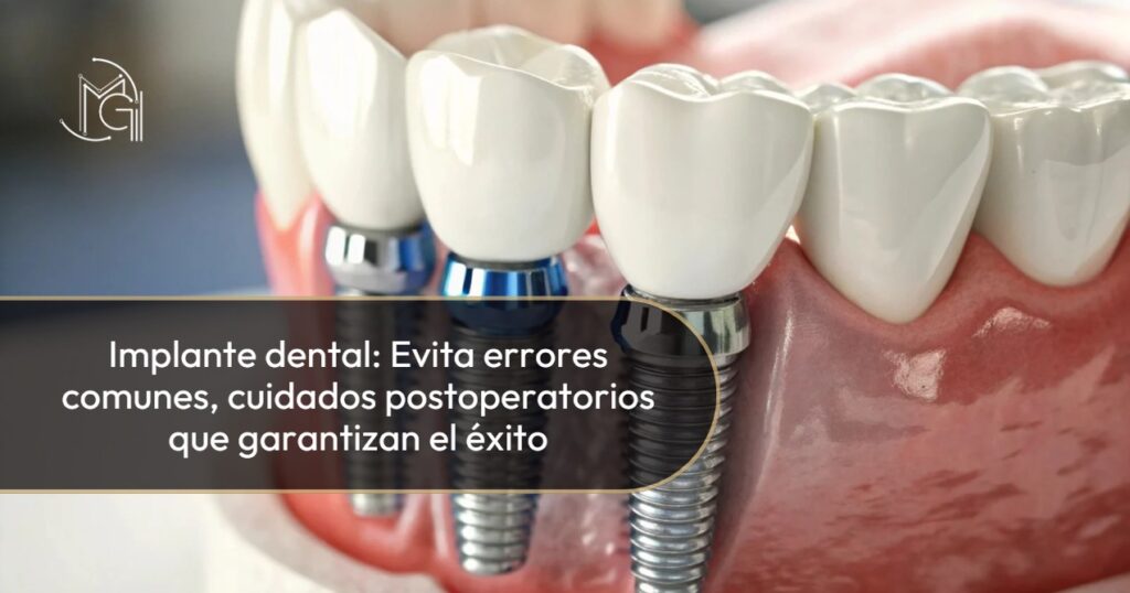 Cuidados implantes dentales-Dra. Carolina Gil