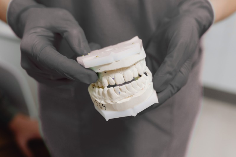 Pérdida del hueso dental en Colombia - Dra. Carolina Gil cirujana maxilofacial en Bogotá