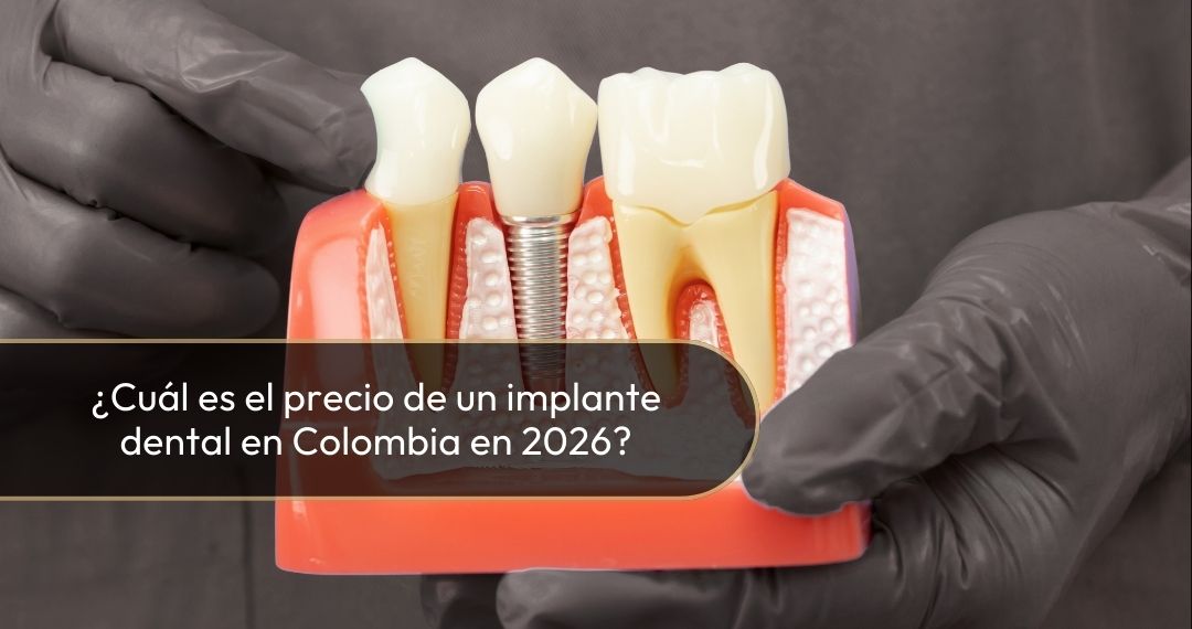 Precio de implantes dentales en Colombia en 2026 - Dra. Carolina Gil, cirujana oral y maxilofacial 2