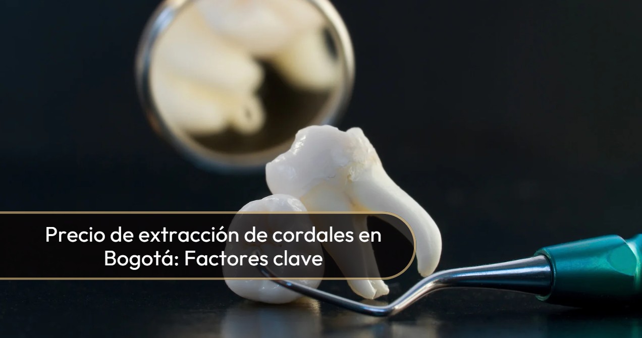 Precio de extracción de cordales en Bogotá-Dra. Carolina Gil