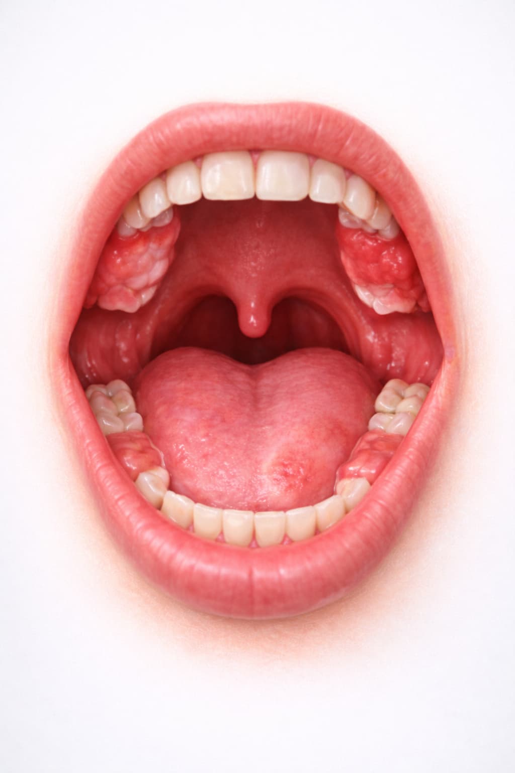 Biosia Oral-Dra. Carolina Gil