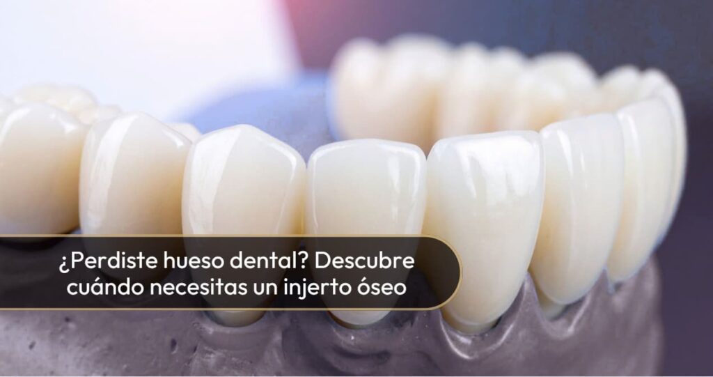 Injerto Óseo-Dra. Carolina Gil