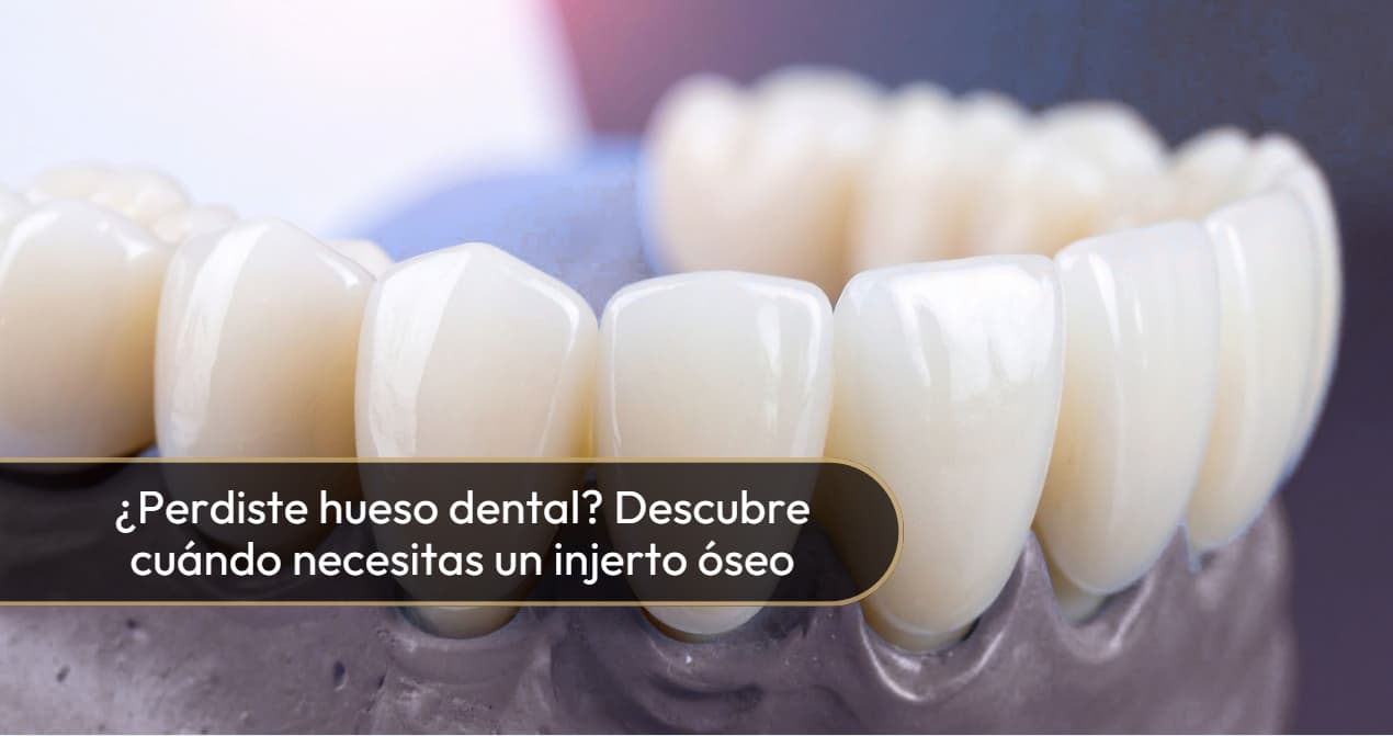 Injerto Óseo-Dra. Carolina Gil