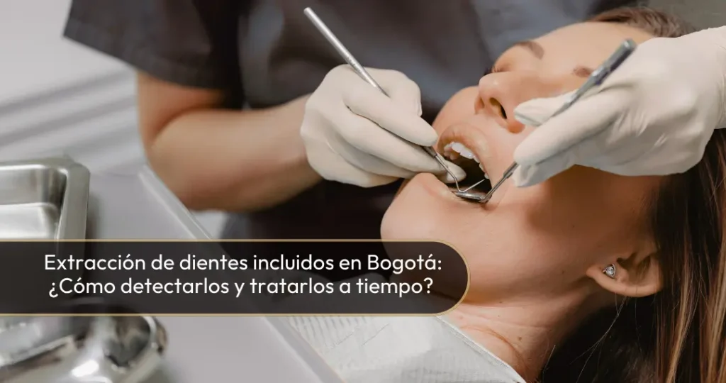 Extracción de dientes incluidos en Bogotá - Dra Carolina Gil