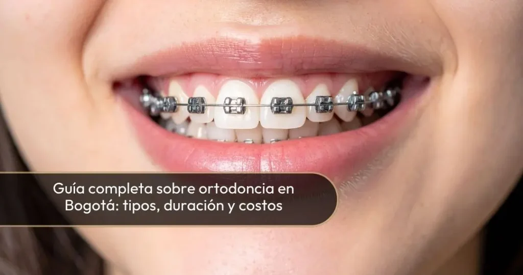 ORTODONCIA EN BOGOTÁ - DRA. CAROLINA GIL