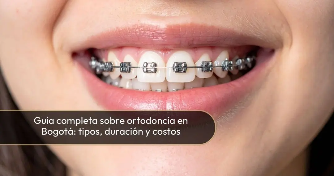 ORTODONCIA EN BOGOTÁ - DRA. CAROLINA GIL