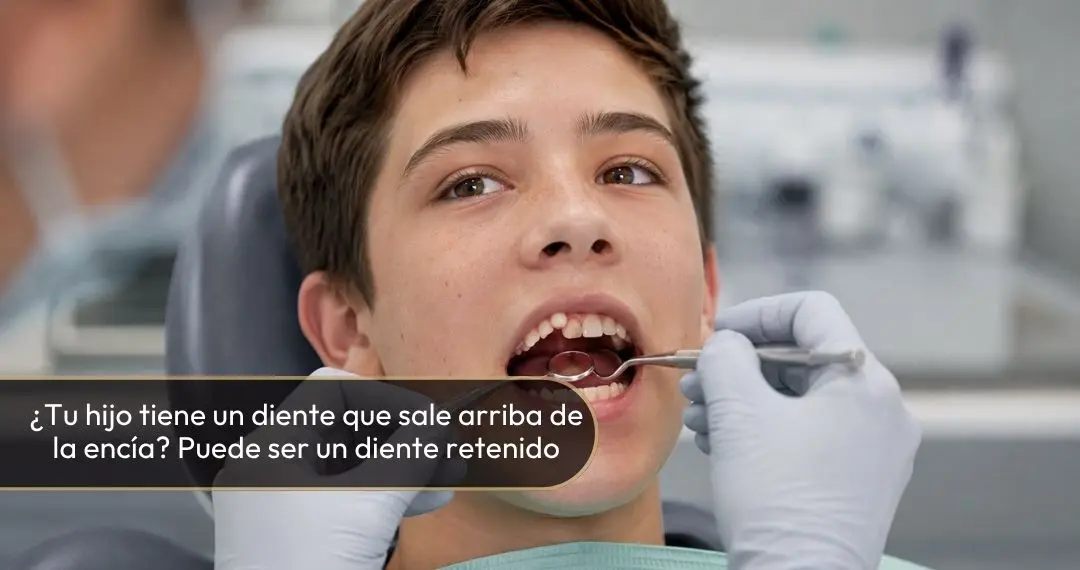 Dientes retenidos en adolescentes - Diente que sale en la encía - Odontóloga y cirujana oral y maxilofacial en Bogotá Dra. Carolina Gil