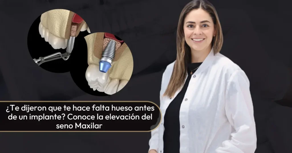 Elevación del seno maxilar- Doctora. Carolina Gil-Cirujana Maxilofacial en Bogotá