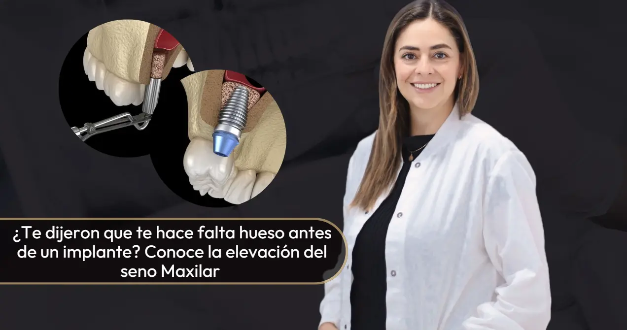 Elevación del seno maxilar- Doctora. Carolina Gil-Cirujana Maxilofacial en Bogotá