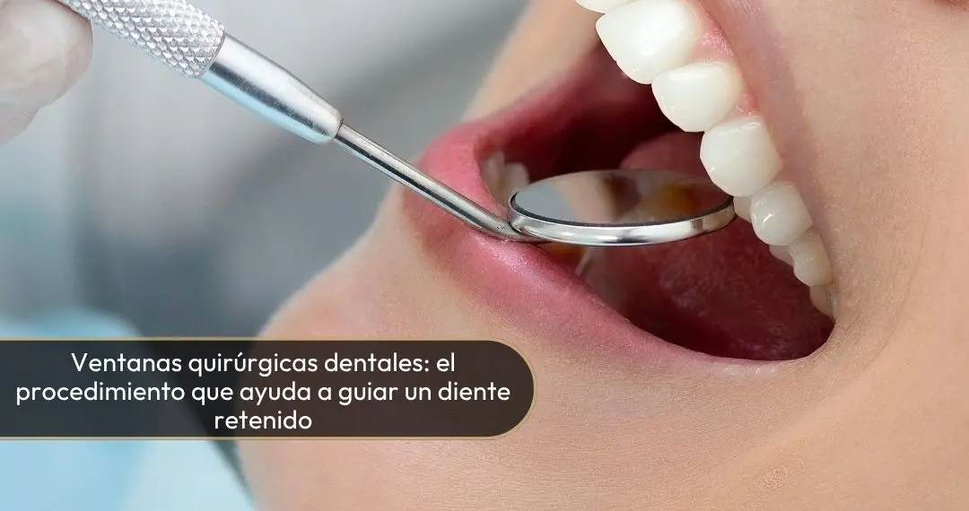 Ventanas quirurgicas dentales - dra Carolina Gil