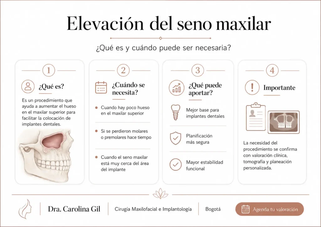 elevación del seno maxilar- Dra. Carolina Gil-Cirujana Maxilofacial en Bogotá- Infografia