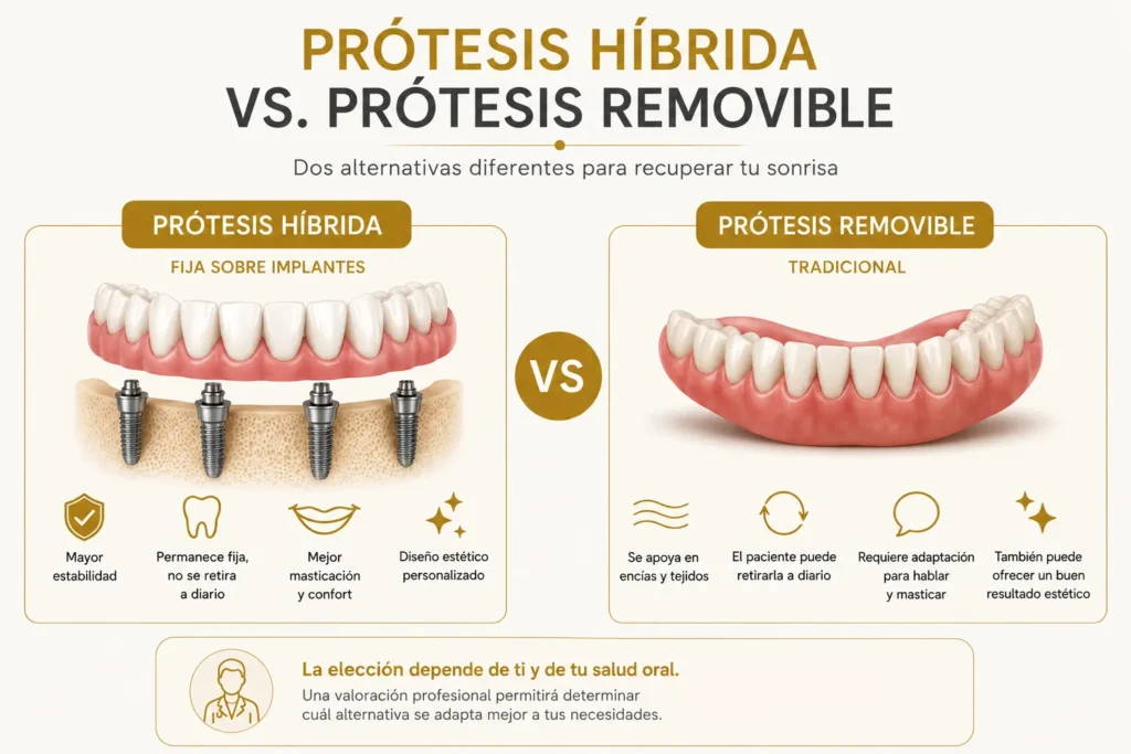 Prótesis híbrida dental o prótesis removible: Diferencias que debes conocer antes de elegir - Protesis hibrida vs removible - Dra Caroliona Gil