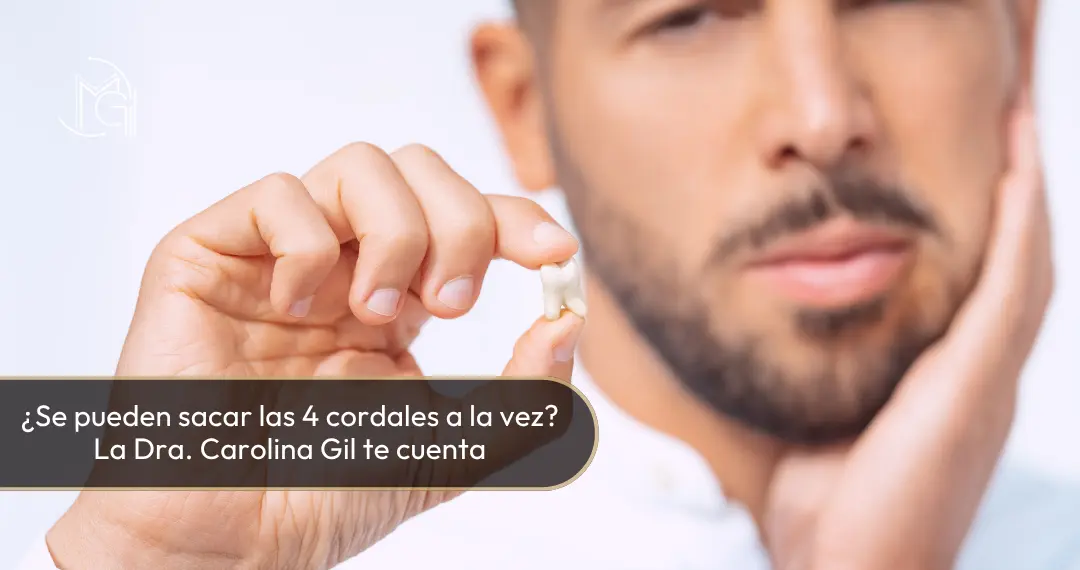 Se pueden sacar las 4 cordales a la vez - Dra Carolina Gil - Bogotá, Colombia