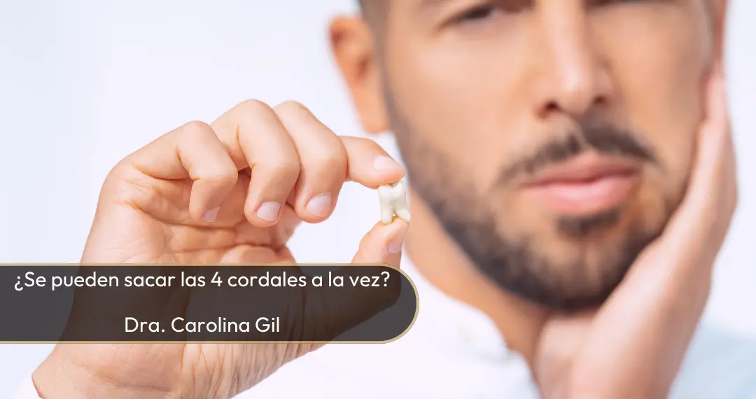 Se pueden sacar las 4 cordales a la vez - Dra. Carolina Gil - Bogotá, Colombia