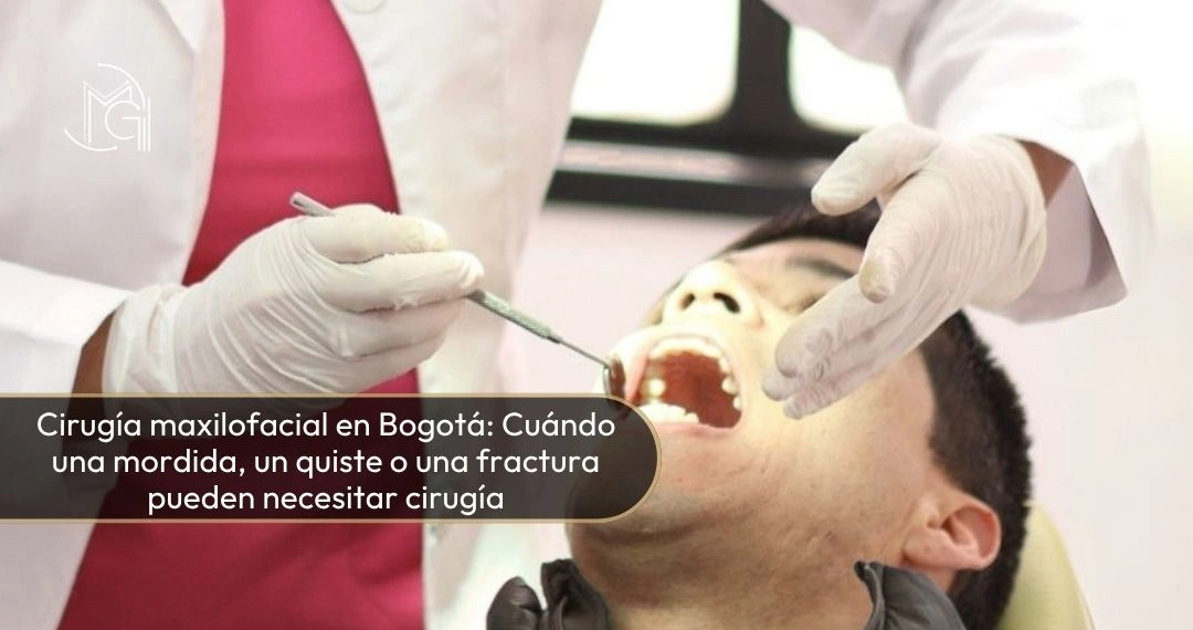 Cirugía maxilofacial en Bogotá cuándo una mordida, un quiste o una fractura pueden necesitar cirugía - Dra Carolina Gil